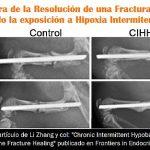 ¿Mejora de la curación de fracturas óseas mediante la realización de Hipoxia Intermitente?